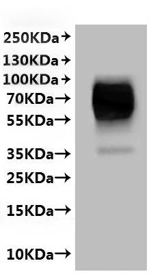 Recombinant Human Hepatic sodium/bile acid cotransporter (SLC10A1)-VLPs