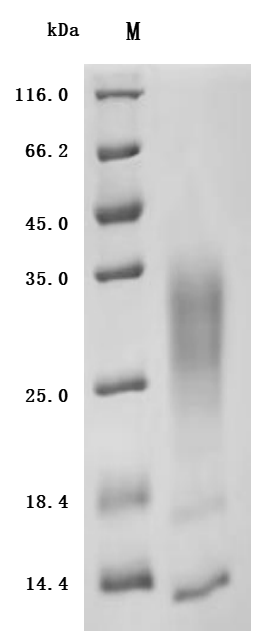 Recombinant Human Interleukin-13 (IL13) (Active)