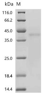 Recombinant Human Tumor Calcium-binding protein 39 CAB39)