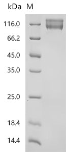 Recombinant Macaca fascicularis ITGAV&ITGB6 Heterodimer Protein