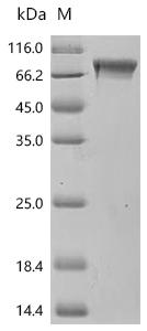 Recombinant Macaca mulatta Coagulation factor IX (F9)