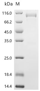 Recombinant Human Endogenous retrovirus group K member 6 Env polyprotein (ERVK-6), partial