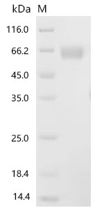 Recombinant Rat Interleukin-1 receptor accessory protein (Il1rap), partial (Active)