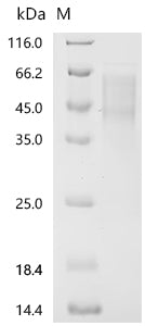 Recombinant MouseV-set domain containing T-cell activation inhibitor 1 (Vtcn1)