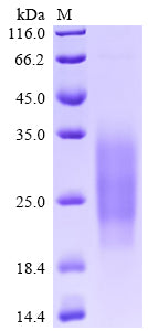 Recombinant Human Single Ig IL-1-related receptor(SIGIRR), partial
