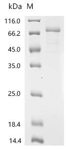 Recombinant Human Protein-arginine deiminase type-6 (PADI6)