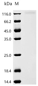 Recombinant Human coronavirus NL63 Spike glycoprotein (S), partial