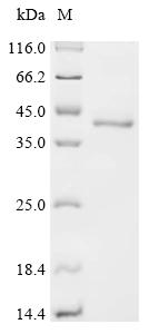 Recombinant Human Collagen and calcium-binding EGF domain-containing protein 1 (CCBE1), partial