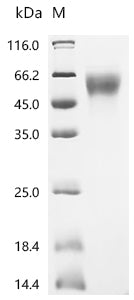 Recombinant Human V-set domain-containing T-cell activation inhibitor 1 (VTCN1) , partial
