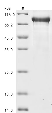 Recombinant Mouse Complement C1s-1 subcomponent (C1s1)