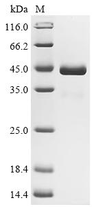 Recombinant Crimean-Congo hemorrhagic fever virus Envelopment polyprotein (GP), partial (Active)