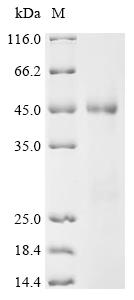 Recombinant Human Pulmonary surfactant-associated protein A2 (SFTPA2), partial