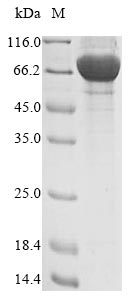 Recombinant Human Extracellular serine/threonine protein kinase FAM20C (FAM20C)