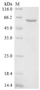 Recombinant Human Angiopoietin-related protein 6 (ANGPTL6)