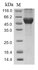 Recombinant Mouse Serine protease inhibitor A3N (Serpina3n)