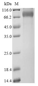 Recombinant Human X-linked retinitis pigmentosa GTPase regulator (RPGR), partial