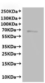 Recombinant Mouse Transient receptor potential cation channel subfamily V member 6 (Trpv6)-VLPs