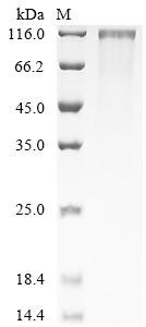 Recombinant Human Mesothelin-like protein (MSLNL), partial
