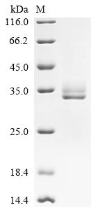 Recombinant Mouse Calcitonin gene-related peptide 1 (Calca), partial