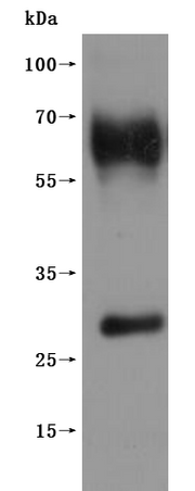 Recombinant Human G-protein coupled receptor 20 (GPR20)-VLPs (Active)