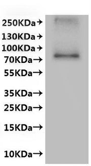 Recombinant Human Transient receptor potential cation channel subfamily V member 6 (TRPV6)-VLPs