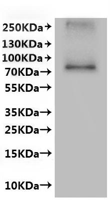 Recombinant Human Transient receptor potential cation channel subfamily V member 6 (TRPV6)-VLPs