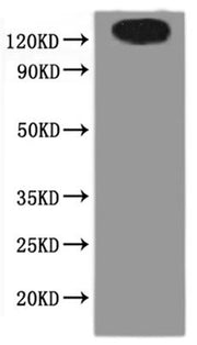Recombinant Human Solute carrier family 23 member 2 (SLC23A2)-VLPs
