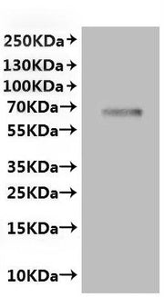 Recombinant Rat Transient receptor potential cation channel subfamily V member 6 (Trpv6)-VLPs