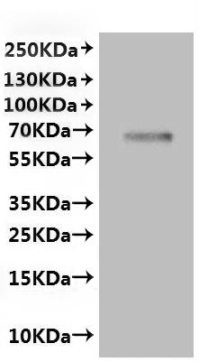 Recombinant Rat Transient receptor potential cation channel subfamily V member 6 (Trpv6)-VLPs