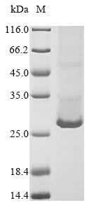 Recombinant Mouse Complement C1q tumor necrosis factor-related protein 3 (C1qtnf3)