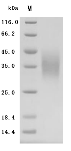 Recombinant Human V-type immunoglobulin domain-containing suppressor of T-cell activation (VSIR), partial (Active)