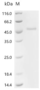 Recombinant Human Platelet-derived growth factor D (PDGFD), partial