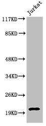 Western Blot analysis of Jurkat cells using Cleaved-Caspase-7 p20 (D198) Polyclonal Antibody