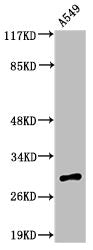 Western Blot analysis of A549 cells using Adiponectin Polyclonal Antibody