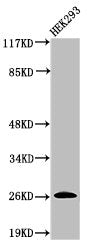 Western Blot analysis of 293 cells using Cleaved-C1r LC (I464) Polyclonal Antibody