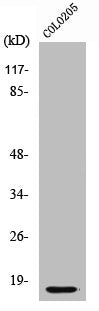 Western Blot analysis of COLO205 cells using Cleaved-Caspase-3 p17 (D175) Polyclonal Antibody