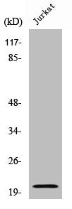Western Blot analysis of Jurkat cells using Cleaved-Caspase-7 p20 (D198) Polyclonal Antibody