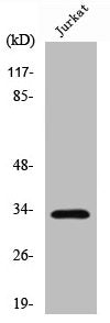 Western Blot analysis of Jurkat cells using Cleaved-Cathepsin A 32k (R326) Polyclonal Antibody