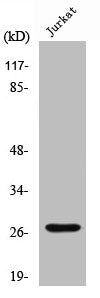 Western Blot analysis of Jurkat cells using Cleaved-Cathepsin C HC (R394) Polyclonal Antibody