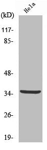 Western Blot analysis of HeLa cells using Cleaved-Cathepsin L2 (L114) Polyclonal Antibody