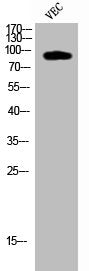 Western Blot analysis of VEC cells using Cleaved-COL1A2 (G1102) Polyclonal Antibody