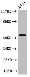 Western Blot analysis of A549 cells using Cleaved-MMP-17 (Q129) Polyclonal Antibody