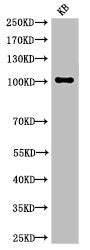 Western Blot analysis of KB cells using Cleaved-Notch 1 (V1754) Polyclonal Antibody