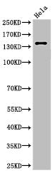 Western Blot analysis of HeLa cells using Cleaved-Spectrin α II (D1185) Polyclonal Antibody