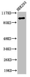 Western Blot analysis of 293 cells using RoXaN Polyclonal Antibody