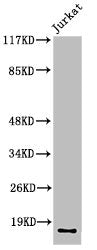 Western Blot analysis of Jurkat cells using Cleaved-Factor VII LC (R212) Polyclonal Antibody