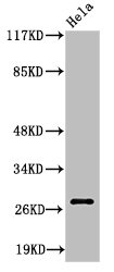 Western Blot analysis of HeLa cells using Cleaved-Integrin α6 LC (E942) Polyclonal Antibody