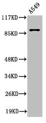 Western Blot analysis of A549 cells using Cleaved-Integrin αV HC (K889) Polyclonal Antibody