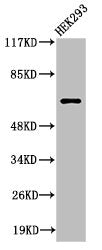 Western Blot analysis of 293 cells using Cleaved-ITI-H2 (D702) Polyclonal Antibody