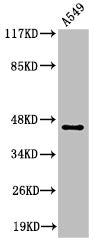Western Blot analysis of A549 cells using Cleaved-MASP-1 HC (R448) Polyclonal Antibody